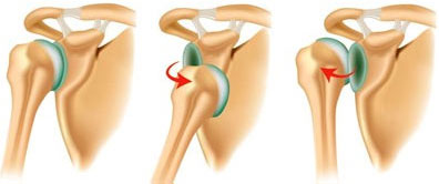 Shoulder Dislocation Treatment in Delhi
