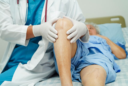 Knee Replacement Surgery in Gurgaon